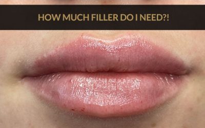 How Much Lip Filler Do I Need? By Dr Ranjbar